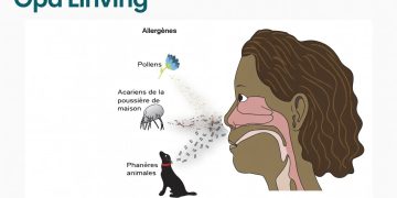 Santé : Un spécialiste du sommeil conseille de suivre ces cinq conseils si vous avez du mal à dormir à cause du rhume des foins